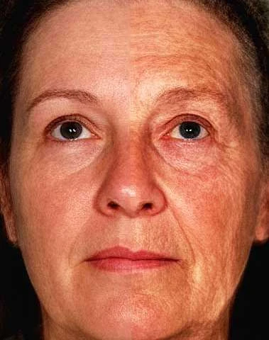 为什么有些人显年轻?因为人家基因好