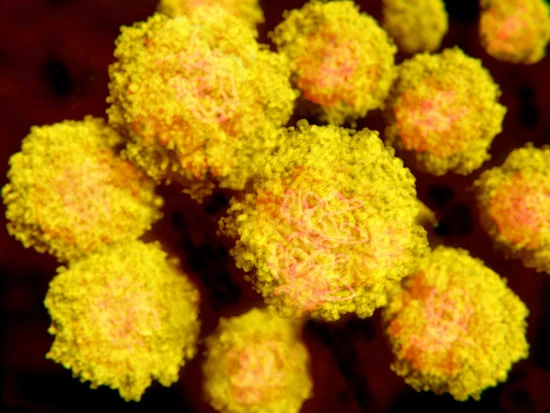 IBM发明埃博拉病毒以及寨卡病毒