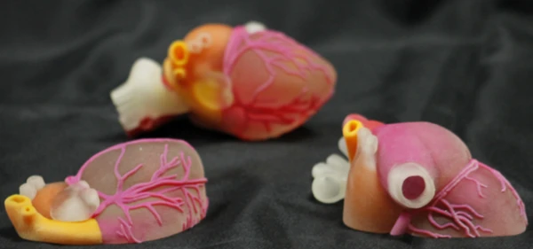 2019年全球3D打印医疗市场销售将达9.66亿美元