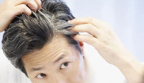 科学家发现人类灰发基因:未来可助推迟头发变白